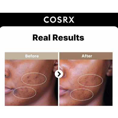 Сироватка для обличчя CosRX The Alpha-Arbutin2 Discoloration Care Serum, 50ml